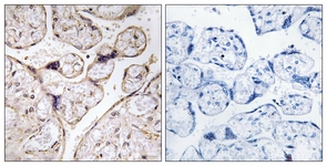 IHC of paraffin-embedded human placenta tissue, using PHCA Antibody. The picture on the right is treated with the synthesized peptide.