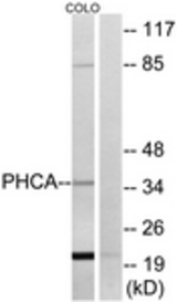 Western blot of extracts from COLO cells, using PHCA Antibody. The lane on the right is treated with the synthesized peptide.