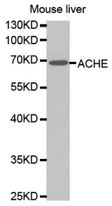 Western blot analysis of extracts of mouse liver tissue lines, using ACHE antibody.
