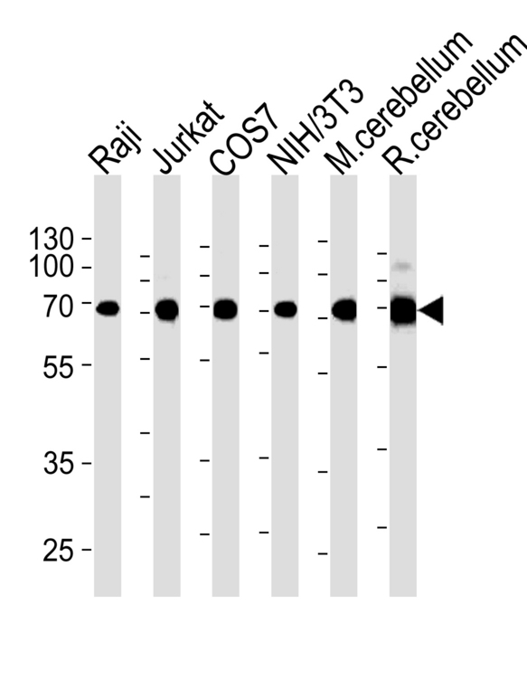 ACHE Antibody western blot of Raji, Jurkat, COS7, mouse NIH/3T3 cell line and mouse cerebellum, rat cerebellum tissue lysates (35 ug/lane). The ACHE antibody detected the ACHE protein (arrow).