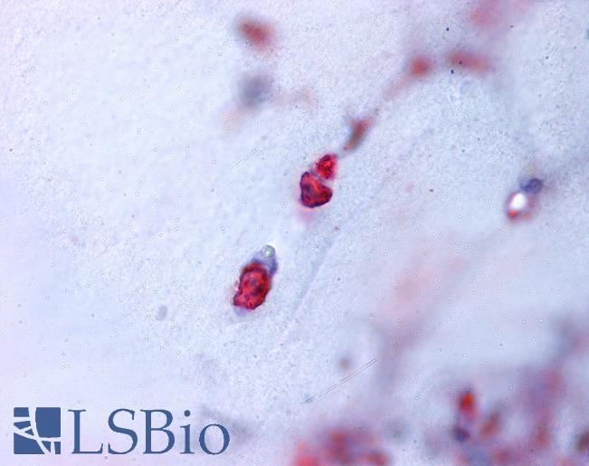 Anti-ACAN / Aggrecan antibody LS-A1556 IHC of human bone, cartilage. Immunohistochemistry of formalin-fixed, paraffin-embedded tissue after heat-induced antigen retrieval.