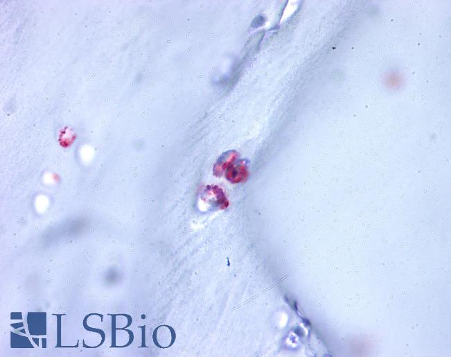 Anti-ACAN / Aggrecan antibody LS-A1562 IHC of human cartilage. Immunohistochemistry of formalin-fixed, paraffin-embedded tissue after heat-induced antigen retrieval.