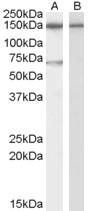 Antibody (0.3 ug/ml) staining of Human Brain (Hippocampus) lysate (35 ug protein in RIPA buffer) with (B) and without (A) blocking with the immunizing peptide. Primary incubation was 1 hour. Detected by chemiluminescence.