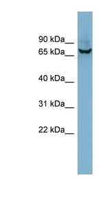 ACHE / Acetylcholinesterase antibody LS-C107765 Western blot of 721_B cell lysate.