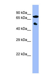 CYP11B2 antibody LS-C107630 Western blot of OVCAR-3 cell lysate.