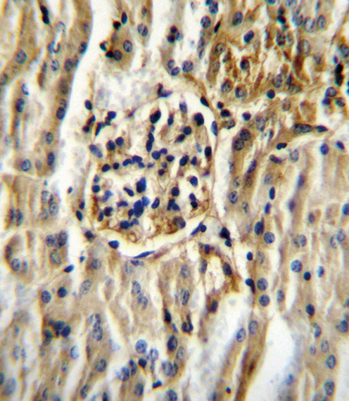 CYP11B2 Antibody immunohistochemistry of formalin-fixed and paraffin-embedded mouse kidney tissue followed by peroxidase-conjugated secondary antibody and DAB staining.