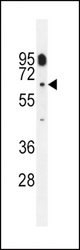 CYP11B2 Antibody western blot of CEM cell line lysates (35 ug/lane). The CYP11B2 antibody detected the CYP11B2 protein (arrow).