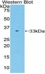 Western blot of recombinant Alpha Fucosidase / FUCA1.