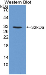 Western blot of recombinant Alpha Fucosidase / FUCA1.