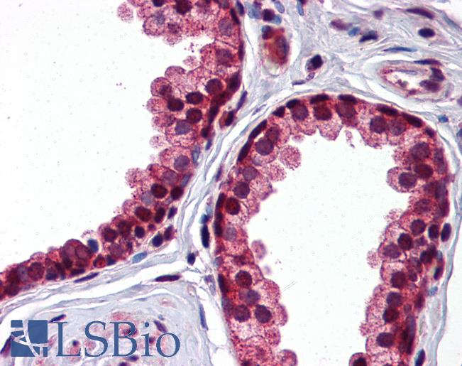Anti-SERPINA3 antibody IHC of human prostate. Immunohistochemistry of formalin-fixed, paraffin-embedded tissue after heat-induced antigen retrieval. Antibody LS-B5826 concentration 2.5 ug/ml.