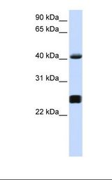 721_B cell lysate. Antibody concentration: 1.0 ug/ml. Gel concentration: 12%.