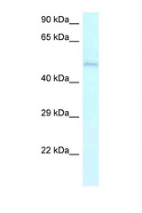 AMBN antibody LS-C145563 Western blot of Jurkat Cell lysate. Antibody concentration 1 ug/ml.