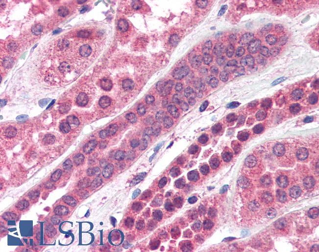 Anti-STXBP6 antibody IHC of human kidney. Immunohistochemistry of formalin-fixed, paraffin-embedded tissue after heat-induced antigen retrieval. Antibody LS-B2750 concentration 75 ug/ml.