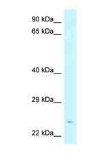 STXBP6 antibody LS-C145713 Western blot of Mouse Thymus lysate. Antibody concentration 1 ug/ml.