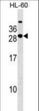 STXBP6 Antibody western blot of HL-60 cell line lysates (35 ug/lane). The STXBP6 antibody detected the STXBP6 protein (arrow).
