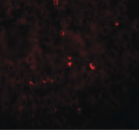 Immunofluorescence of ANG in human liver tissue with ANG antibody at 20 ug/ml.