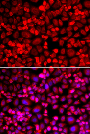 Immunofluorescence blot of HeLa cell using ANLN antibody. Blue: DAPI for nuclear staining.