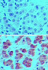 IHC ofAPG7L in formalin-fixed, paraffin-embedded human liver tissue using an isotype control (top) and LS-C148584 (bottom) at 5 ug/ml.