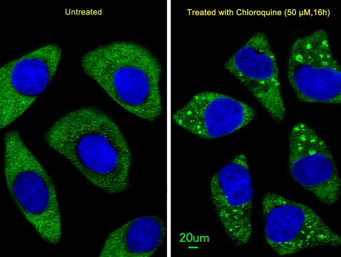 Immunofluorescent of U251 cells, using ATG7 Antibody. U251 cells(right) were treated with Chloroquine (50 mu M,16h). Antibody was diluted at 1:25 dilution. Alexa Fluor 488-conjugated goat anti-rabbit lgG at 1:400 dilution was used as the secondary antibody (green). DAPI was used to stain the cell nuclear (blue).