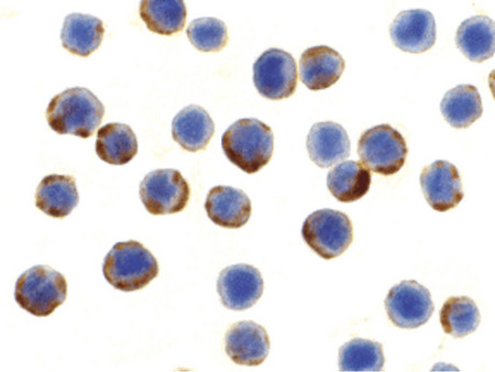 Immunocytochemistry of APG7 in MCF7 cells with APG7 antibody at 10 ug/ml.
