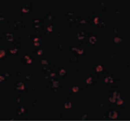 Immunofluorescence of APG7 in MCF7 cells with APG7 antibody at 20 ug/ml.