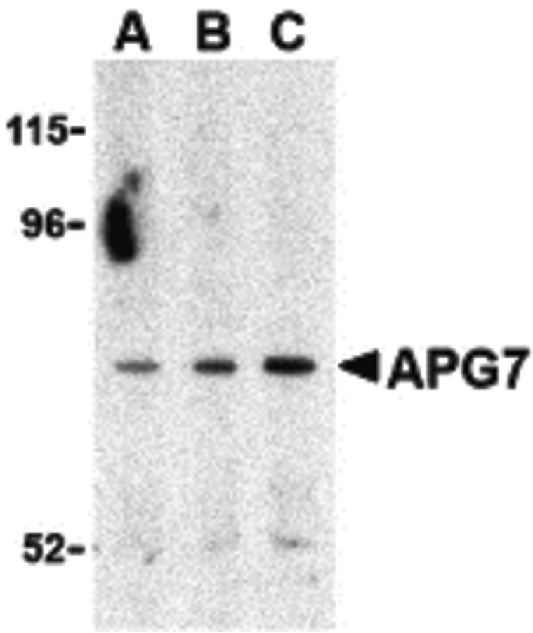 Western blot of APG7 in Caco-2 cell lysate with APG7 antibody at (A) 0.5, (B) 1 and (C) 2 ug/ml.