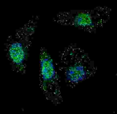 Fluorescent image of U251 cells stained with ATG7 antibody. U251 cells were treated with Chloroquine (50 mu M,16h), then fixed with 4% PFA (20 min), permeabilized with Triton X-100 (0.2%, 30 min). Cells were then incubated ATG7 primary antibody (1:200, 2 h at room temperature). For secondary antibody, Alexa Fluor 488 conjugated donkey anti-rabbit antibody (green) was used (1:1000, 1h). Nuclei were counterstained with Hoechst 33342 (blue) (10 ug/ml, 5 min). ATG7 immunoreactivity is localized to autophagic vacuoles in the cytoplasm of U251 cells, supported by Human Protein Atlas Data (http://www.proteinatlas.org/ENSG00000197548).