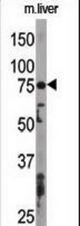 The anti-APG7L antibody is used in Western blot to detect APG7L in mouse liver tissue lysate. APG7L(arrow) was detected using the purified antibody.