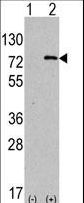 Western blot of anti-hAPG7L-R509 antibody in 293 cell line lysates transiently transfected with the ATG7 gene (2 ug/lane). hAPG7L-R509(arrow) was detected using the purified antibody.