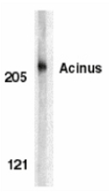 Western blot of Acinus in K562 whole cell lysate with Acinus antibody at 1 ug/ml.