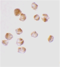 Immunocytochemical staining of K562 cells using Acinus antibody at 10 µg/ml.