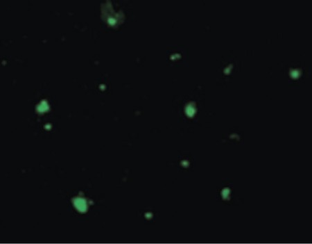 Immunofluorescence of Acinus in HeLa cells with Acinus antibody at 10 ug/ml.