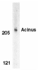 Western blot of Acinus in K562 whole cell lysate with Acinus antibody at 1 ug/ml.