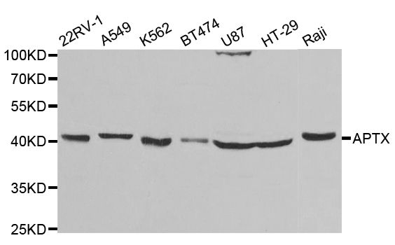 Western blot analysis of extracts of various cell lines, using APTX antibody.