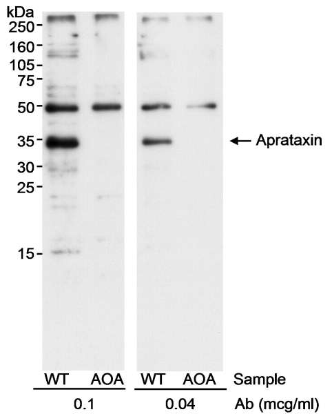 Detection of Human Aprataxin by Western Blot. Samples: Whole cell lysate (50 ug) from normal human lymphoblasts (C3ABR cells; WT) or lymphoblasts from an AOA patient (738RM cells; AOA). Antibody: Affinity purified rabbit anti-Aprataxin antibody used at 0.1 and 0.04 ug/ml. Detection: Chemiluminescence with an exposure time of 2 minutes.