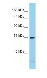 ACIN1 / Acinus antibody Western Blot of Mouse Small Intestine. Antibody dilution: 1 ug/ml.