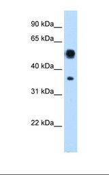 Transfected 293T cell lysate. Antibody concentration: 0.25 ug/ml. Gel concentration: 12%.