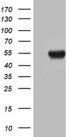 HEK293T cells were transfected with the pCMV6-ENTRY control (Left lane) or pCMV6-ENTRY ASL (Right lane) cDNA for 48 hrs and lysed. Equivalent amounts of cell lysates (5 ug per lane) were separated by SDS-PAGE and immunoblotted with anti-ASL.
