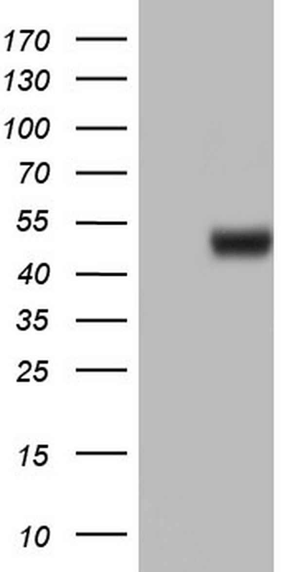 HEK293T cells were transfected with the pCMV6-ENTRY control (Left lane) or pCMV6-ENTRY ASL (Right lane) cDNA for 48 hrs and lysed. Equivalent amounts of cell lysates (5 ug per lane) were separated by SDS-PAGE and immunoblotted with anti-ASL.