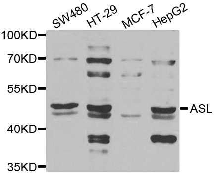 Western blot analysis of extracts of various cell lines, using ASL antibody.