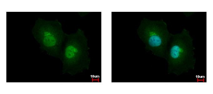 ASL antibody detects ASL protein at cytoplasm and nucleus by immunofluorescent analysis. HeLa cells were fixed in 4% paraformaldehyde at RT for 15 min. ASL protein stained by ASL antibody diluted at 1:500.