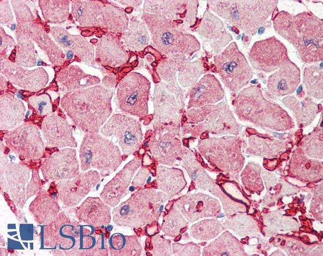 Anti-GOT1 antibody IHC of human heart. Immunohistochemistry of formalin-fixed, paraffin-embedded tissue after heat-induced antigen retrieval. Antibody LS-B2405 concentration 5 ug/ml.