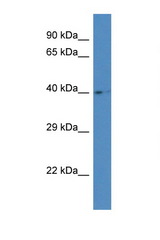 AGA antibody LS-C145615 Western blot of Placenta lysate. Antibody concentration 1 ug/ml.