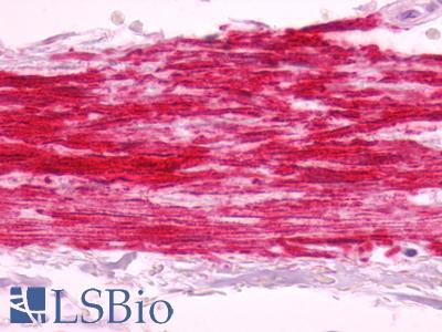 Anti-B1R / BDKRB1 antibody IHC of human artery, smooth muscle, atherosclerosis. Immunohistochemistry of formalin-fixed, paraffin-embedded tissue after heat-induced antigen retrieval. Antibody LS-A799 dilution 5 ug/ml.