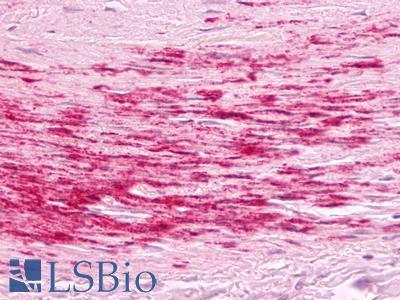 Anti-B1R / BDKRB1 antibody IHC of human artery, smooth muscle, atherosclerosis. Immunohistochemistry of formalin-fixed, paraffin-embedded tissue after heat-induced antigen retrieval. Antibody LS-A799 dilution 5 ug/ml.