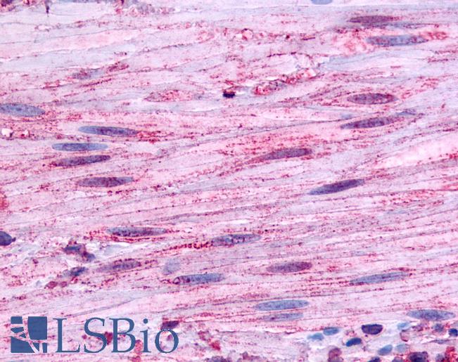 Anti-BDKRB1 antibody LS-A3579 IHC of human smooth muscle. Immunohistochemistry of formalin-fixed, paraffin-embedded tissue after heat-induced antigen retrieval.
