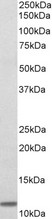 B2M antibody (0.3 ug/ml) staining of Human Duodenum lysate (35 ug protein in RIPA buffer). Primary incubation was 1 hour. Detected by chemiluminescence.