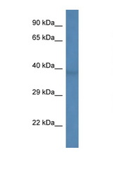 B3GALNT1 antibody LS-C135167 Western blot of Rat Muscle lysate. Antibody concentration 1 ug/ml.