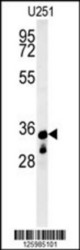 B3GALNT1 Antibody (N-term)Western blot of U251 cell line lysates (35 ug/lane). This demonstrates the B3GALNT1 antibody detected the B3GALNT1 protein (arrow).