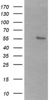 HEK293T cells were transfected with the pCMV6-ENTRY control (Left lane) or pCMV6-ENTRY B3GALNT2 (Right lane) cDNA for 48 hrs and lysed. Equivalent amounts of cell lysates (5 ug per lane) were separated by SDS-PAGE and immunoblotted with anti-B3GALNT2.